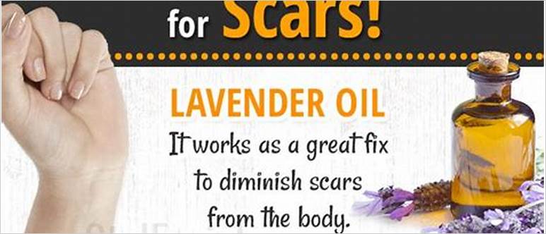 Oils that help scars